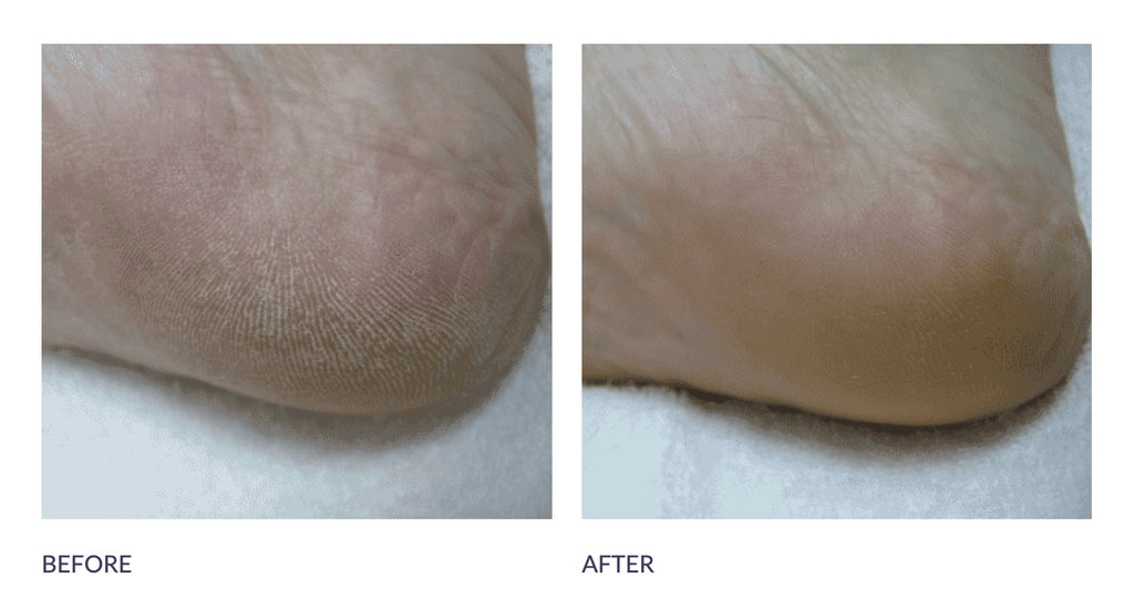 Footlogix Soins Quotidiens 2 - Dealorys 